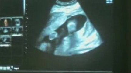 Amaia - Montage amateur -