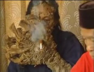 De l'homme »Treeman 'implore de l'aide comme il se transform