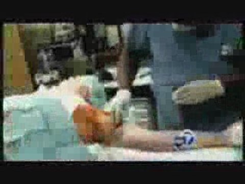 Plastic Surgery Sweat Glands