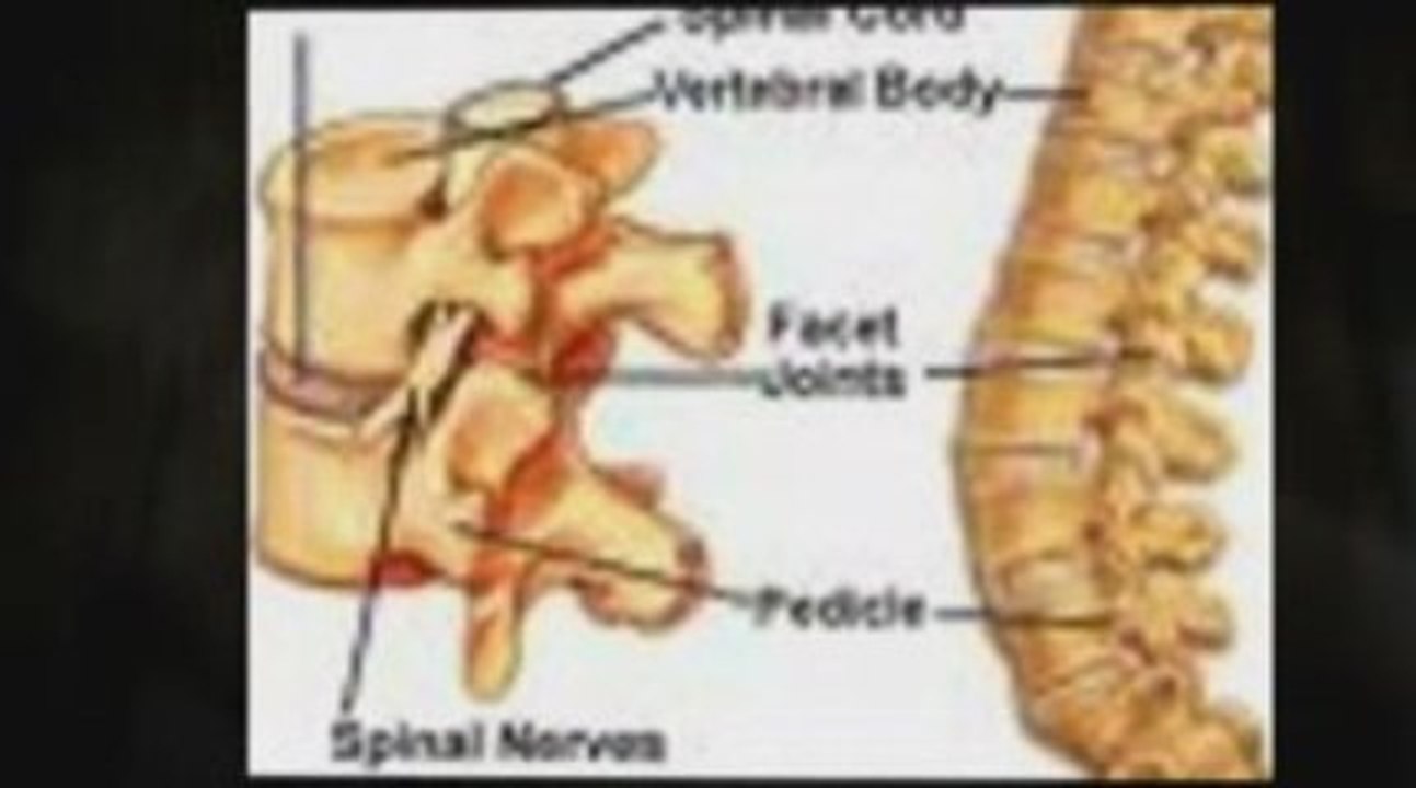 New Painless and Gentle Treatments for Back Pain