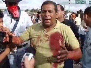 TESTIMONIO: MASACRE EN HONDURAS