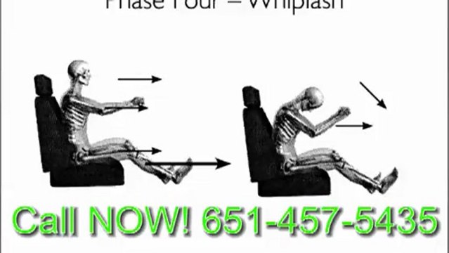 Finest Twin Cities Chiropractic: Numbness Relief