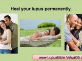 treatment for lupus - lupus butterfly rash