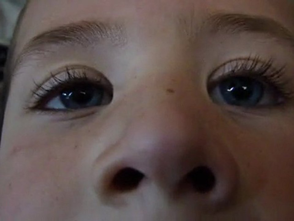 le nystagmus de mon ptit singe