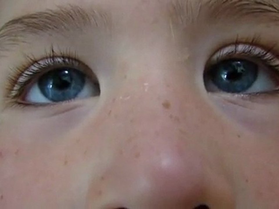 nystagmus de mon ptit singe