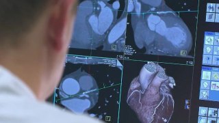 Identifying Heart Diseases - Computed Tomography