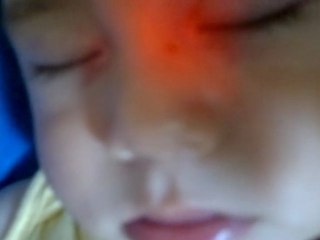 Je crois qu'il le tire de son grand pere maternel ca hihihi