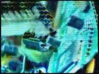 Complete brainwash neurosurgery