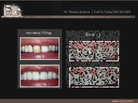 Barrington Illinois Cosmetic Dentist Dr. Thomas Jackson, DDS