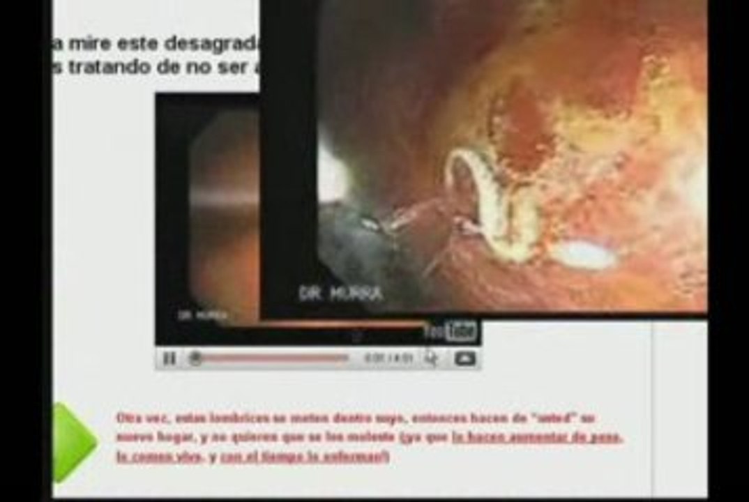 como perder peso-el mejor metodo para quemar calorias