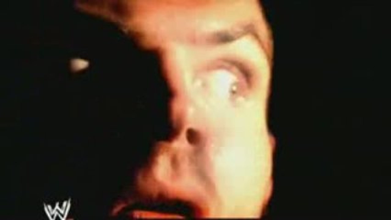 Jeff Hardy Comatose