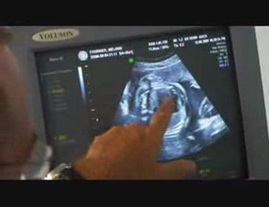echo 1208 part 1