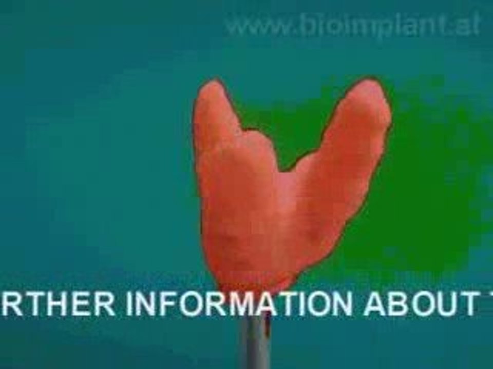 WORLD'S FIRST TRULY ANATOMIC MULTI-ROOTED ZIRCONIA IMPLANT