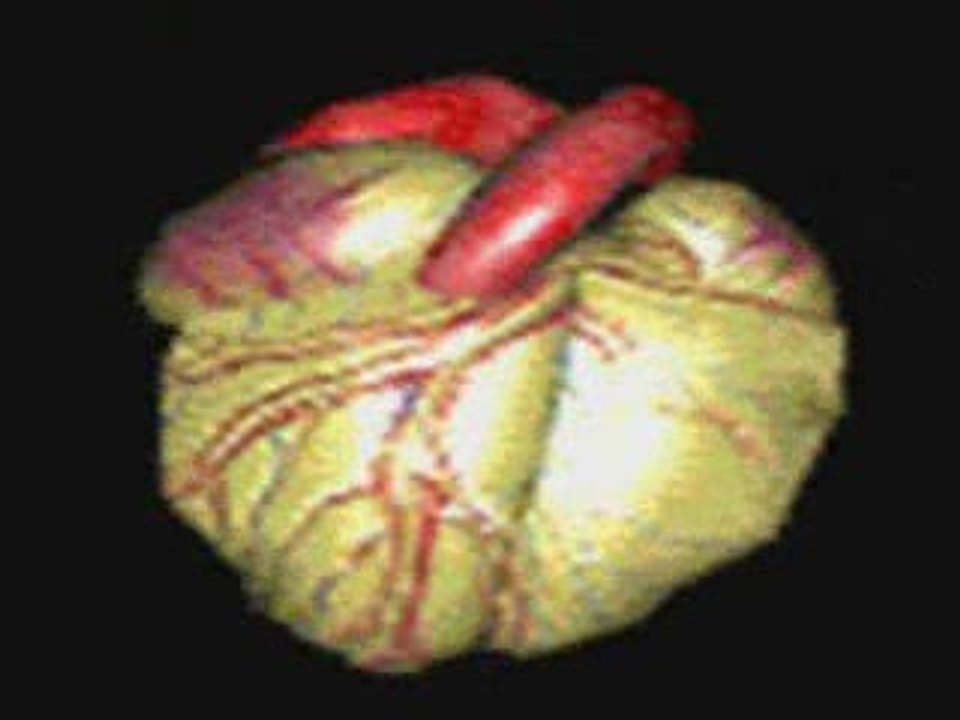 Techno - Hitch Hiker + Dumont -  Journey Of Love - SR Remix