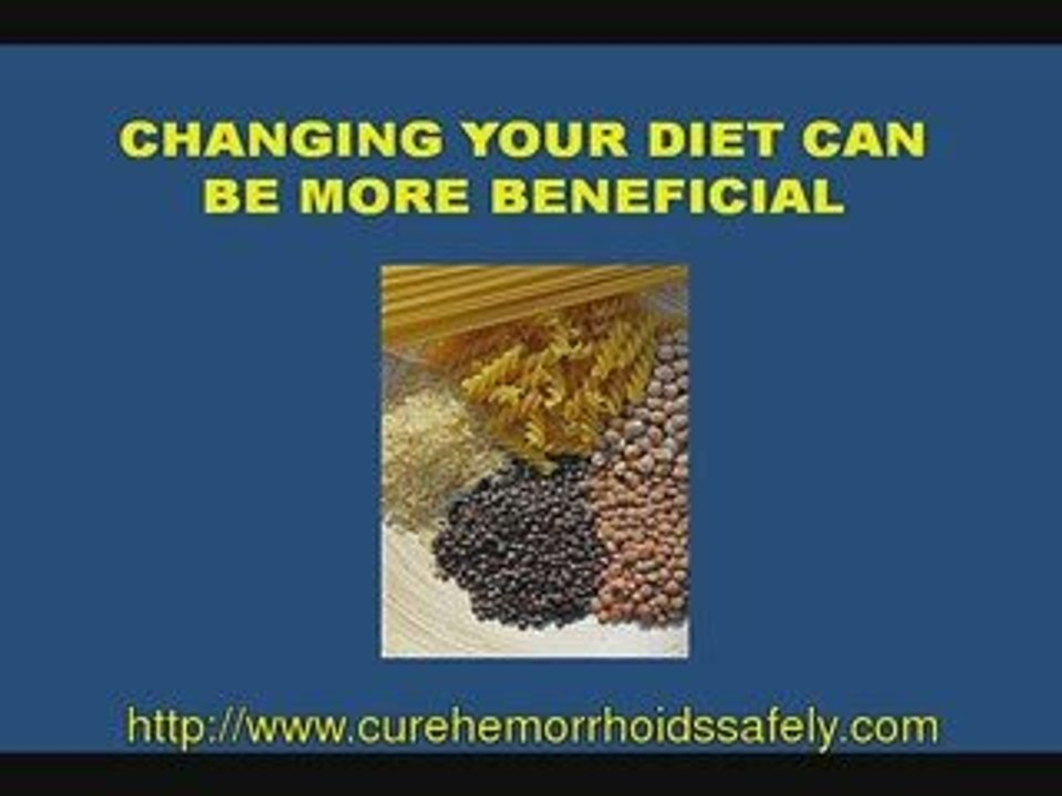 Cure Hemorrhoids Safely