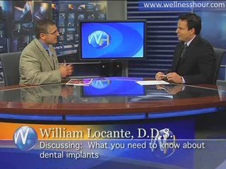 Dr. William Locante - The Benefits of Dental Implants