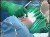 Revision Rhinoplasty Reconstructive Surgery Toronto
