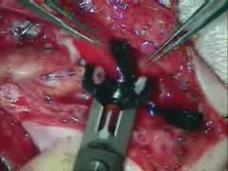 Vascular Surgery,Vascular Surgery India, India Vascular Dise