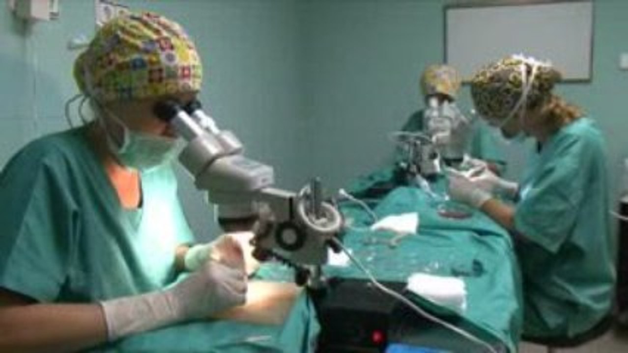 TRASPLANTE PELO O MICROINJERTO CAPILAR CIRUGIA CATALAN