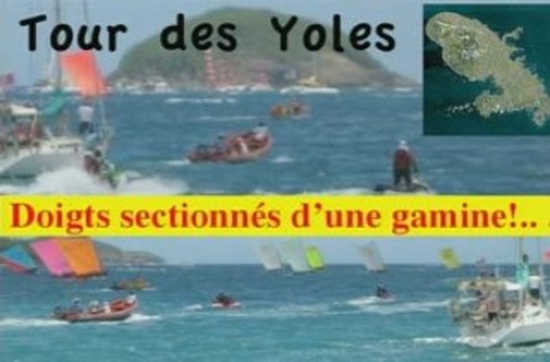 Doigts Arrachés Jeune Fille Tour des Yoles 2009 Martinique