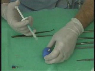 iroot sp kanal dolgu patı