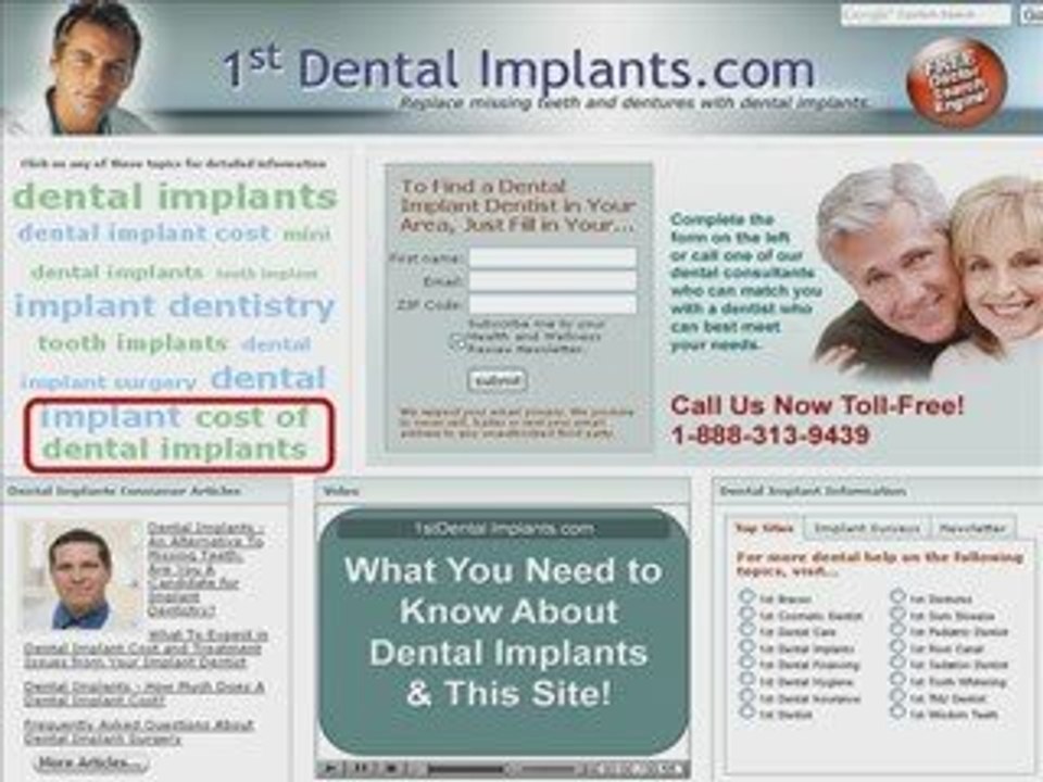 Searching for a Dental Implants Dentist?