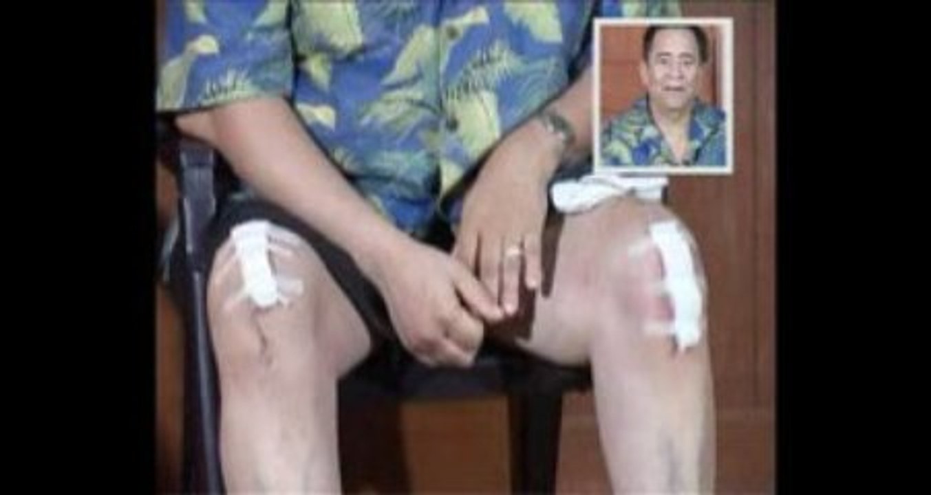 California to Chennai- American doc's trip for 2 knees