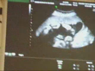 grossesse et naissance de nolann_0001