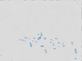 How to Make Money With Google AdSense