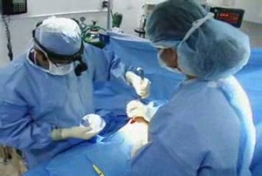 Breast Enlargement Surgery with Silicone Implants in LA 