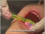 Higiene oral odontologos de cali colombia