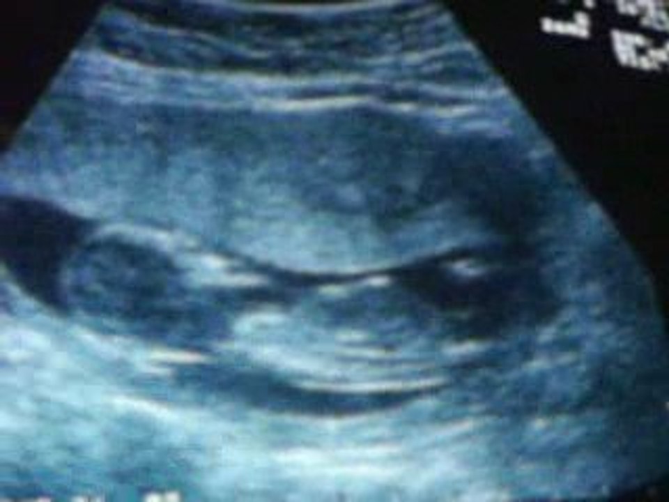 La crevette le retour ^^