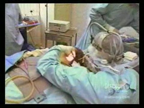 Dr. Antell explains Botox Injections