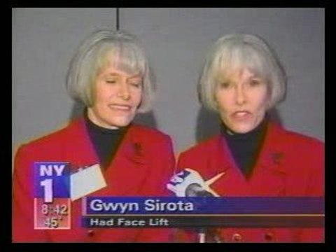 Twins Aging study, Facelift research