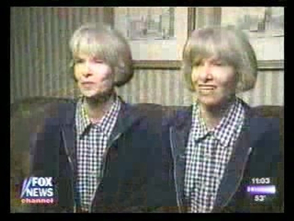 Plastic Surgery and aging Study with Twins