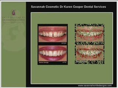 Savannah Georgia (GA) Cosmetic Dentist Dr Karen Cooper, DDS