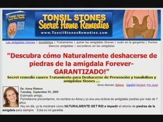 COMO CURARSE LAS AMIGDALAS