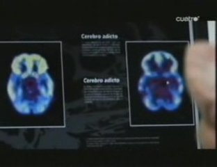 Cannabis y cerebro: Rafael Maldonado