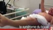 syndrome guillain-barré le syndrome du bocal  D.Pujadas