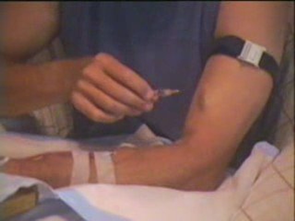 Hemodyalisis