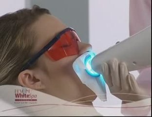 Teeth Whitening EverWhite Glasgow Scotland