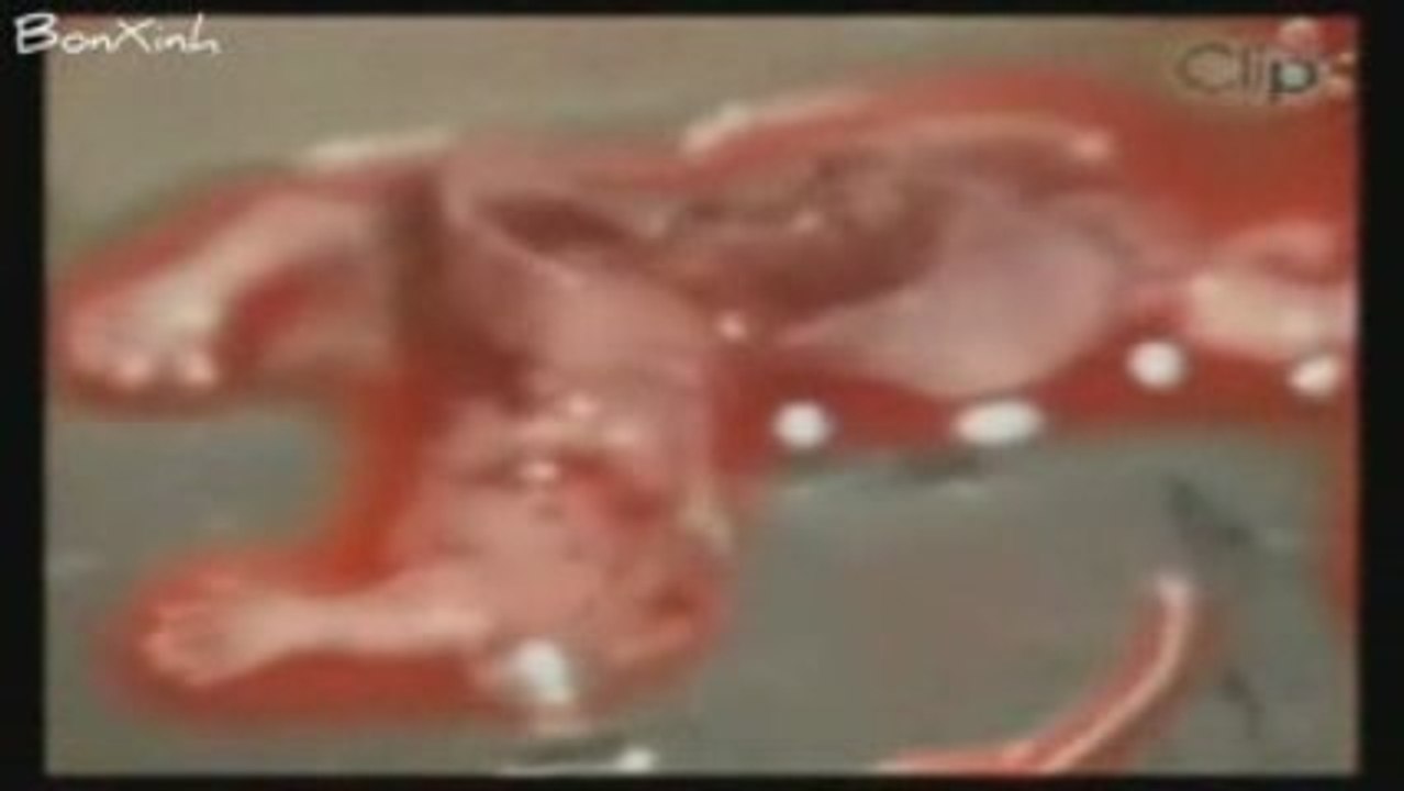 Nỗi lòng thai nhi - BonXinh ft. Lynk Lee