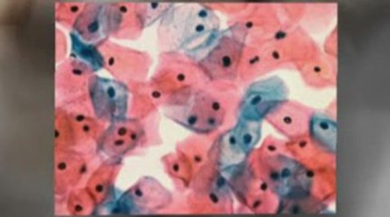Gainesville, FL Mesothelioma Lawyer