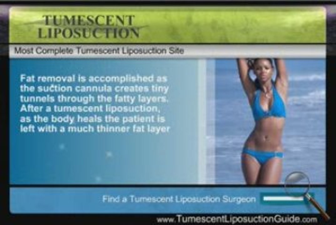 Tumescent Liposuction # 9