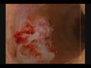 Every Cigarette is Doing Your Dammage