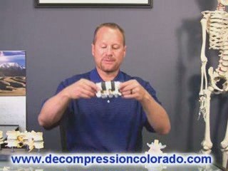 Spinal Decompression Colorado Centennial, Englewood, Parker