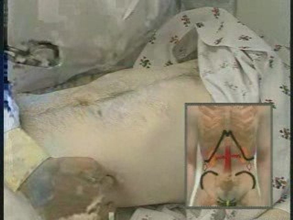 Abdomen-Part2