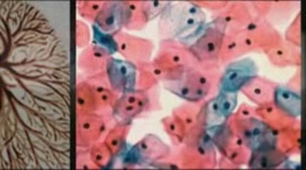 North Las Vegas, NV Mesothelioma Lawyer