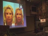 Fat Transfer Lecture2/Cedars-Sinai/Los Angeles/Beverly Hills