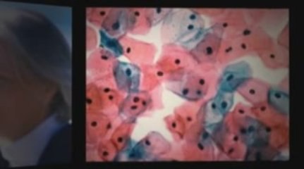 Durham, NC Mesothelioma Lawyer